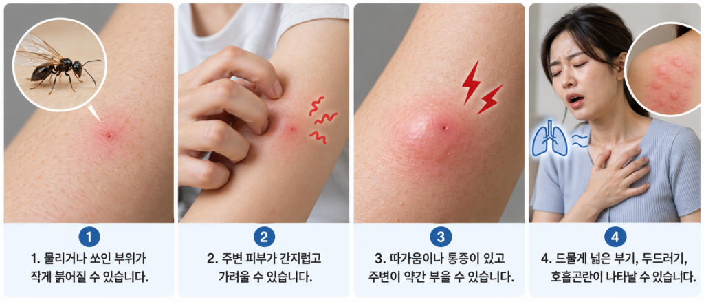 날개미 물린 자국과 가려움, 통증, 부기 증상